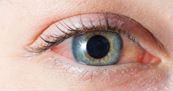 Cómo afecta la contaminación a los ojos